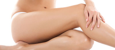 Sclerotherapy Los Angeles