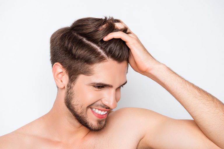 Male hair loss and hair transplant