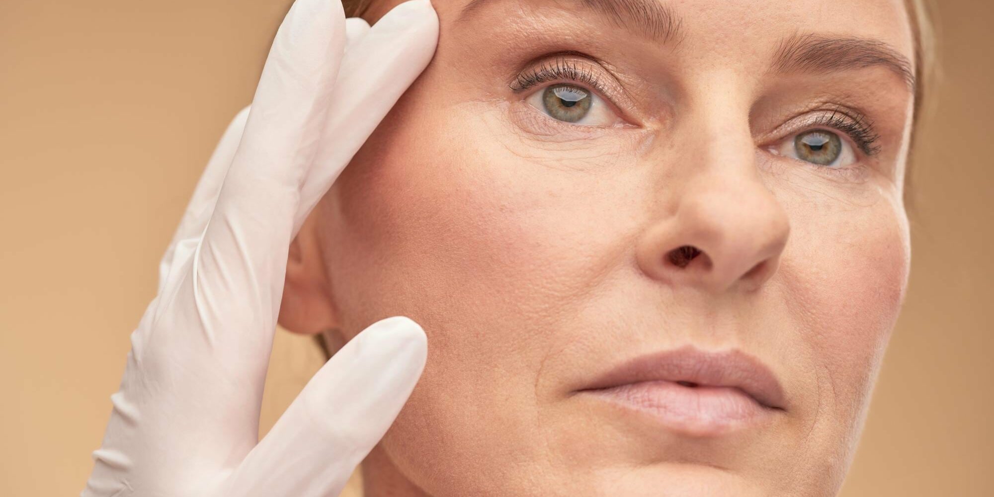 How to get rid of botox vein How to get rid of botox vein