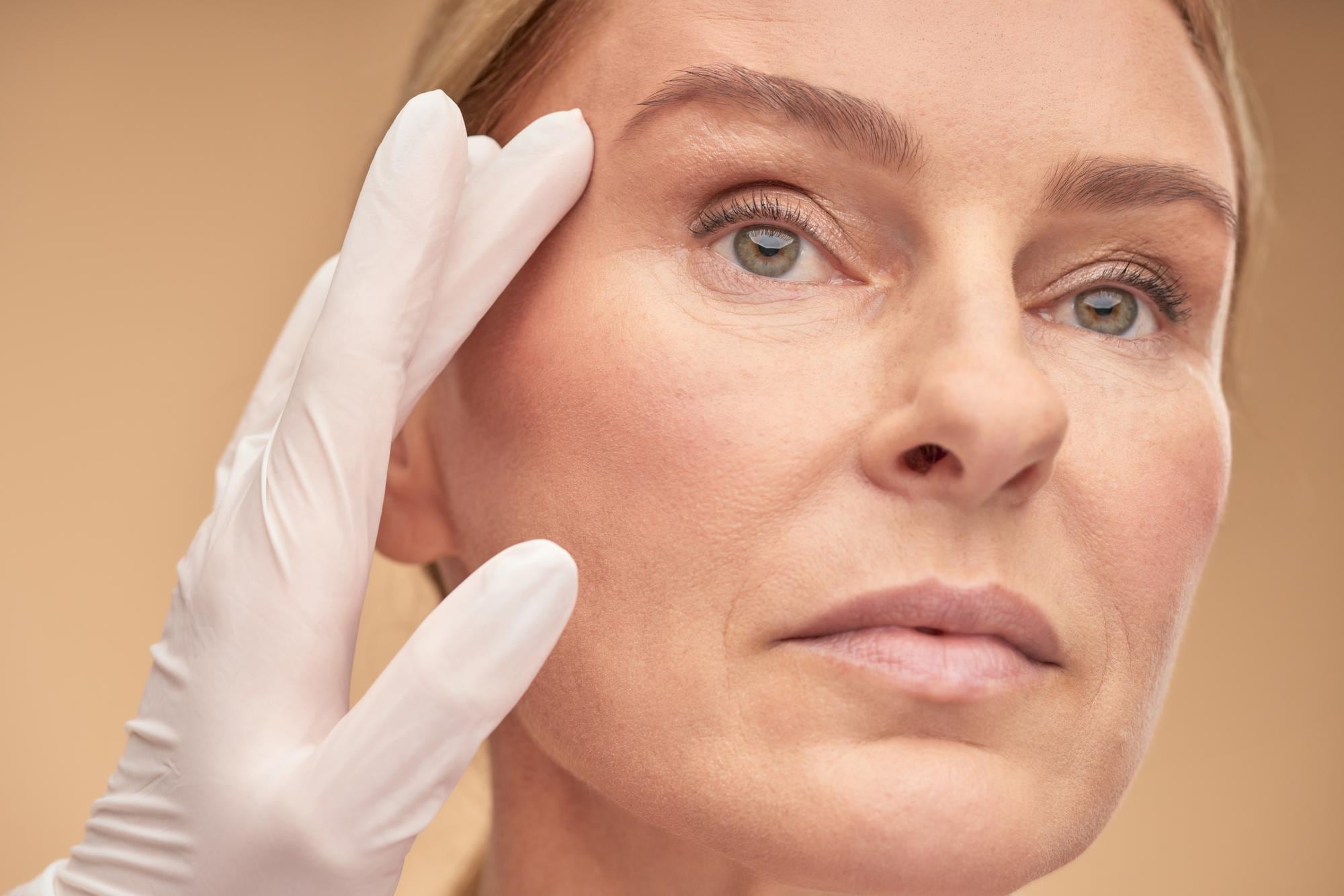 How to get rid of botox vein