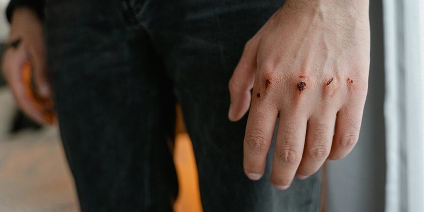 chronic wound management strategies